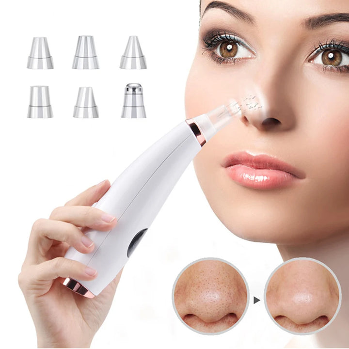 Electric Blackhead Remover Acne Cleaner Black Spot Removal Facial Deep Cleansing